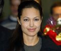  Анджелина Джоли стала жертвой пластики 